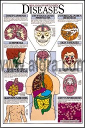 Aids and Opportunistic Diseases Poster