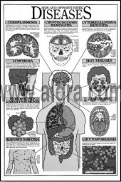 Aids and Opportunistic Diseases Study Sheets