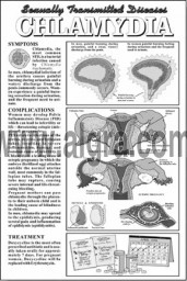 Chlamydia Study Sheet