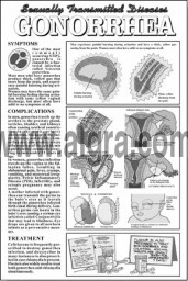 Gonorrhea Study Sheet