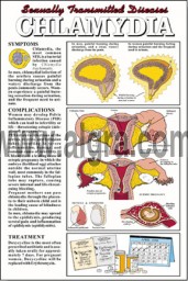 Chlamydia Poster