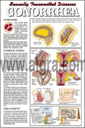 Gonorrhea Poster 