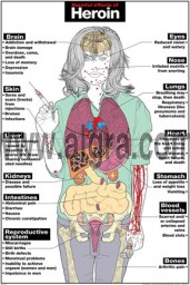 Harmful Effects of Heroin Poster