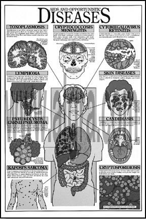 Aids and Opportunistic Diseases Study Sheets