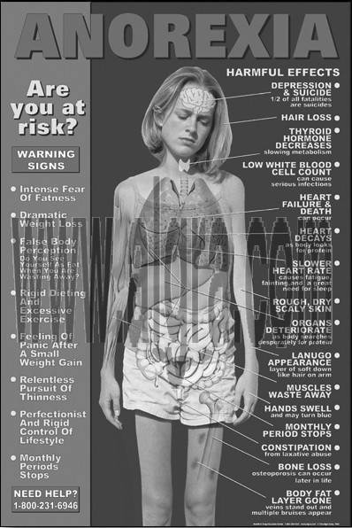 Anorexia Study Sheet