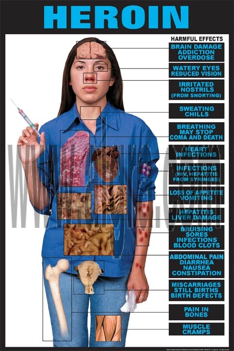Heroin Effects Transparency