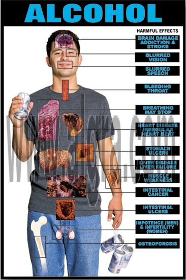 Effects of Alcohol Poster
