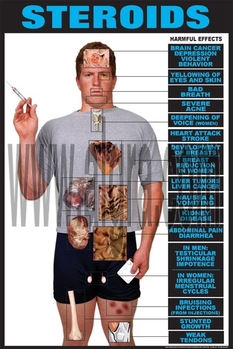 Effects of Steroids Poster