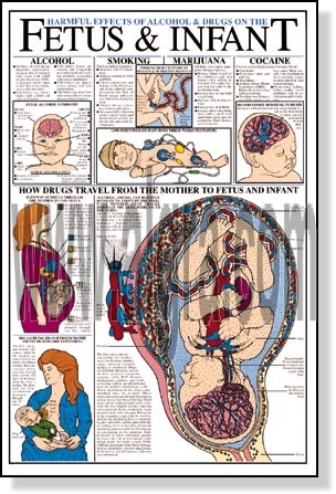 Alcohol & Drug Effects on the Fetus Poster
