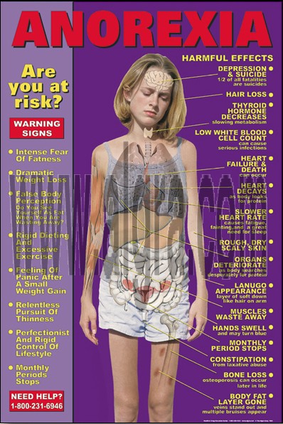 Anorexia Poster