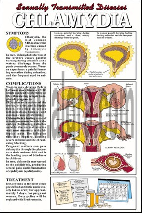 Chlamydia Poster
