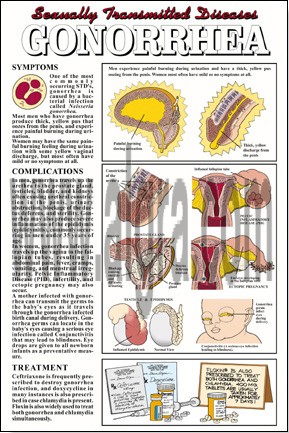 Gonorrhea Poster 