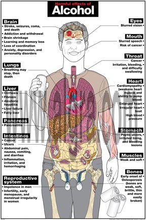 Harmful Effects of Alcohol Poster
