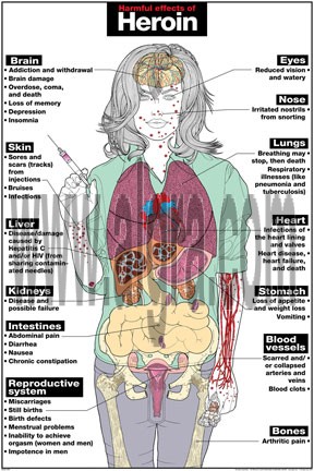 Harmful Effects of Heroin Poster