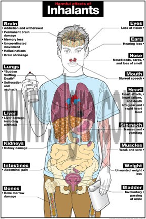 Harmful Effects of Inhalants Poster