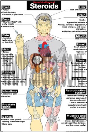 Harmful Effects of Steroids Poster