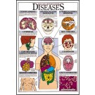 Aids and Opportunistic Diseases Poster