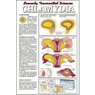 Chlamydia Poster